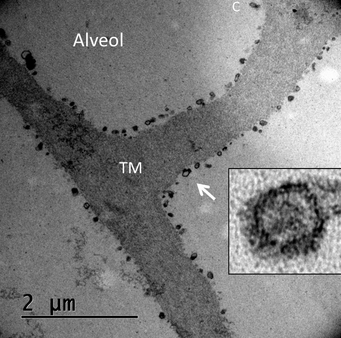 Alveoli in the porous membrane
