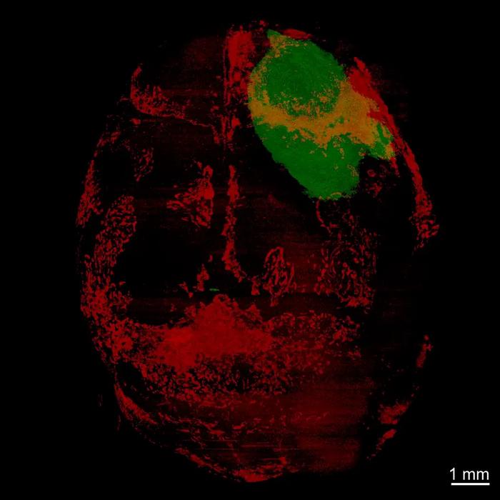 This 3D image shows the brain and skull of a glioblastoma mouse model. The green area is the tumor; the red areas are where bone-eating osteoclast cells have accumulated in the skull.