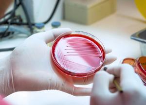 Blood agar plate in lab