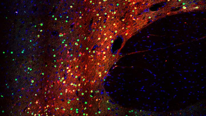 Rat Nucleus Accumbens