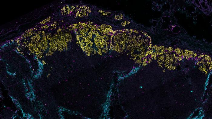 Lymph node and lymphatic vessels