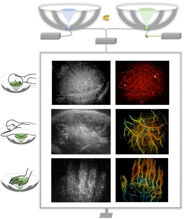 Bringing Optical Color to Ultrasound