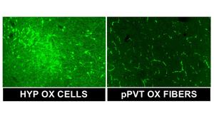 Functional interaction between orexin/dynorphin transmission in the posterior paraventricular nucleus of the thalamus following alcohol dependence: mediation of alcohol-seeking behavior