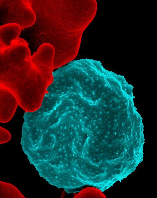 A Red Blood Cell Infected with Malaria Parasites