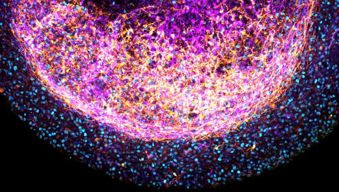Brain organoid - zoom
