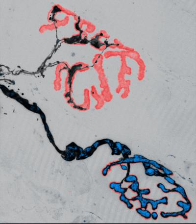 Nerve-Muscle Synapses in a Mouse Model of ALS