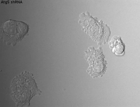 Time-Lapse Video of Cancer Cells Lacking Autophagy-Related Genes