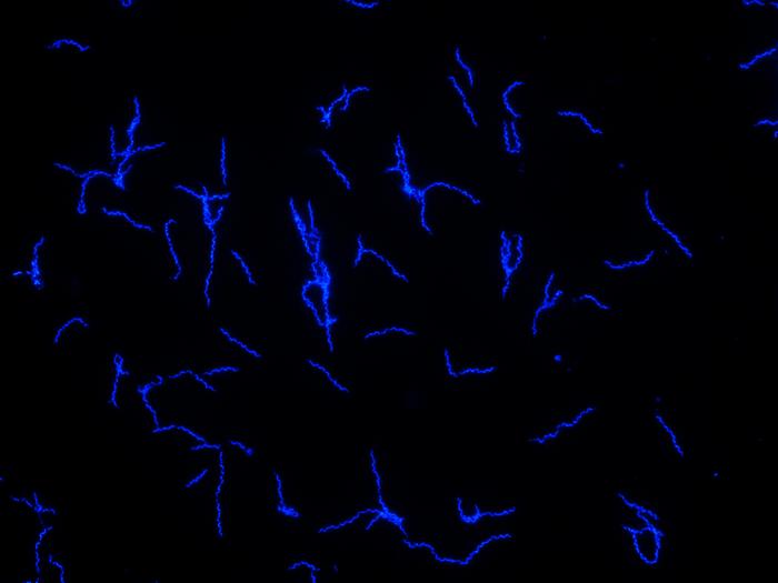 Borrelia recurrentis