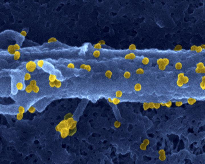 Chikungunya Virus