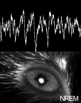 Pupil Size Coupling to Cortical States