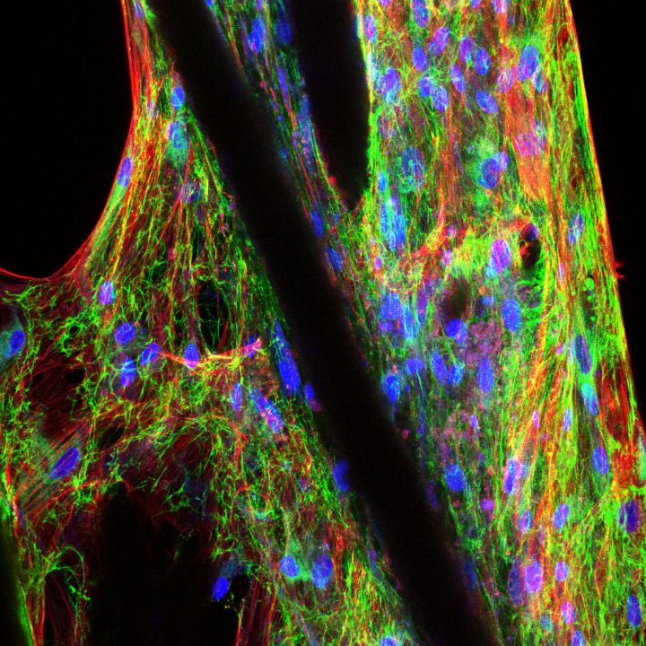Scaffold with Human Mesenchymal Precursor Cells
