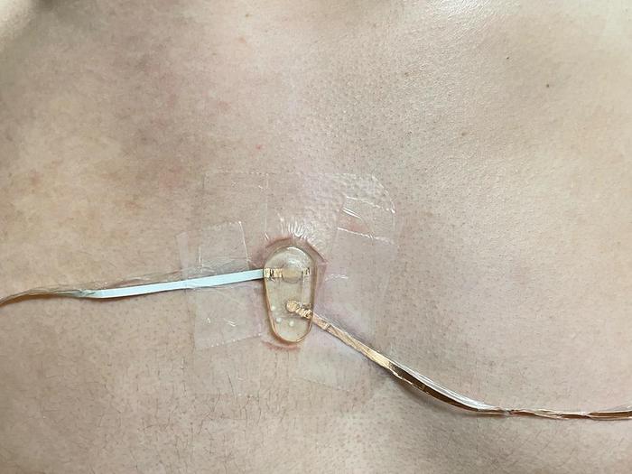 sensor attached directly to a subject's chest