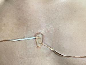 sensor attached directly to a subject's chest