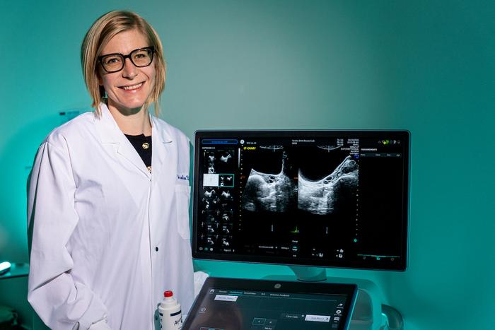 Researchers push for polycystic ovary syndrome to get a new name
