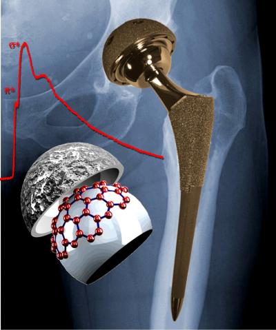 Carbon Layer Holds Clues to Improving Metal Hip Replacements (1 of 2)
