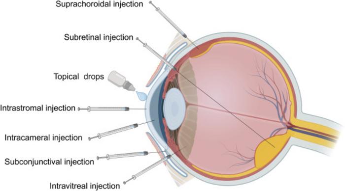 Delivery Routes in Ocular Tissues
