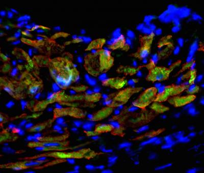 Heart Cells