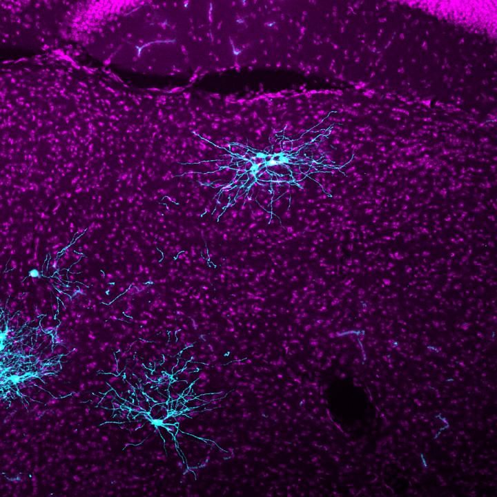 Improved Brain Mapping Tool 20 Times More Powerful than Previous Version