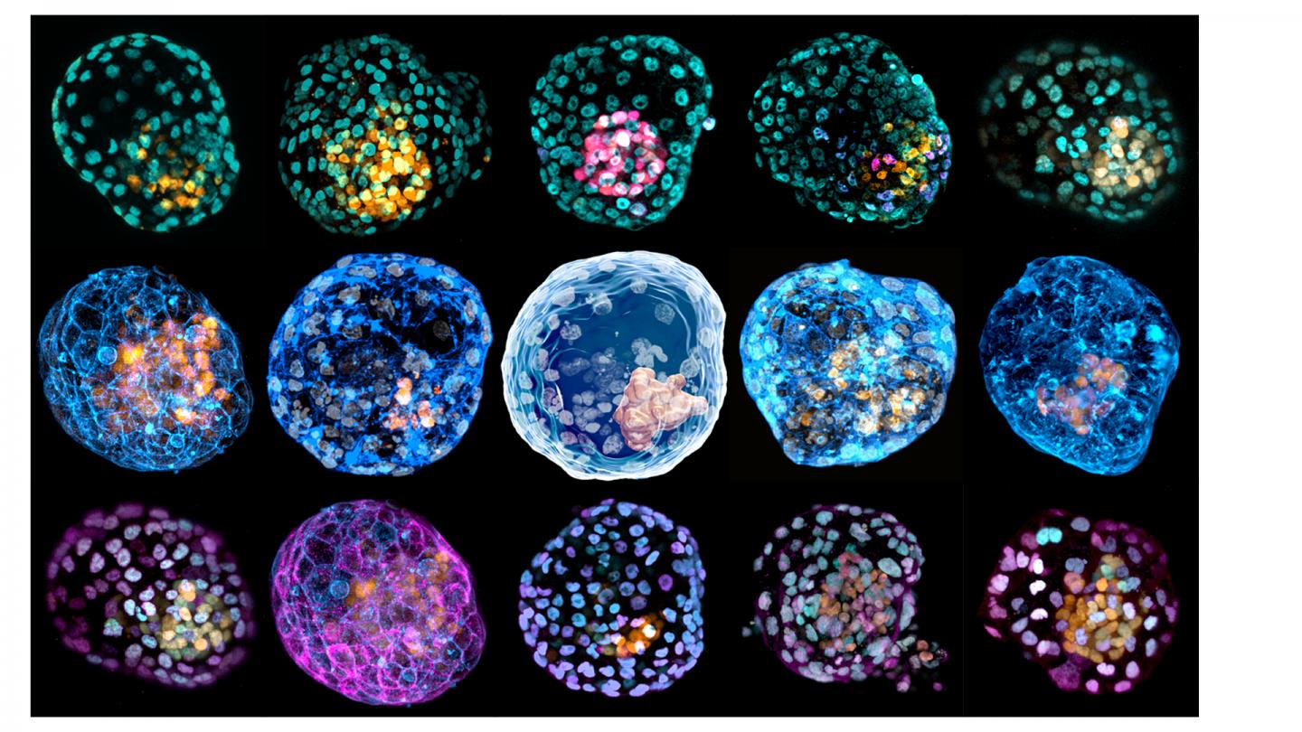iBlastoids