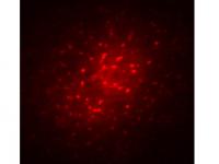Astrocyte with Marker