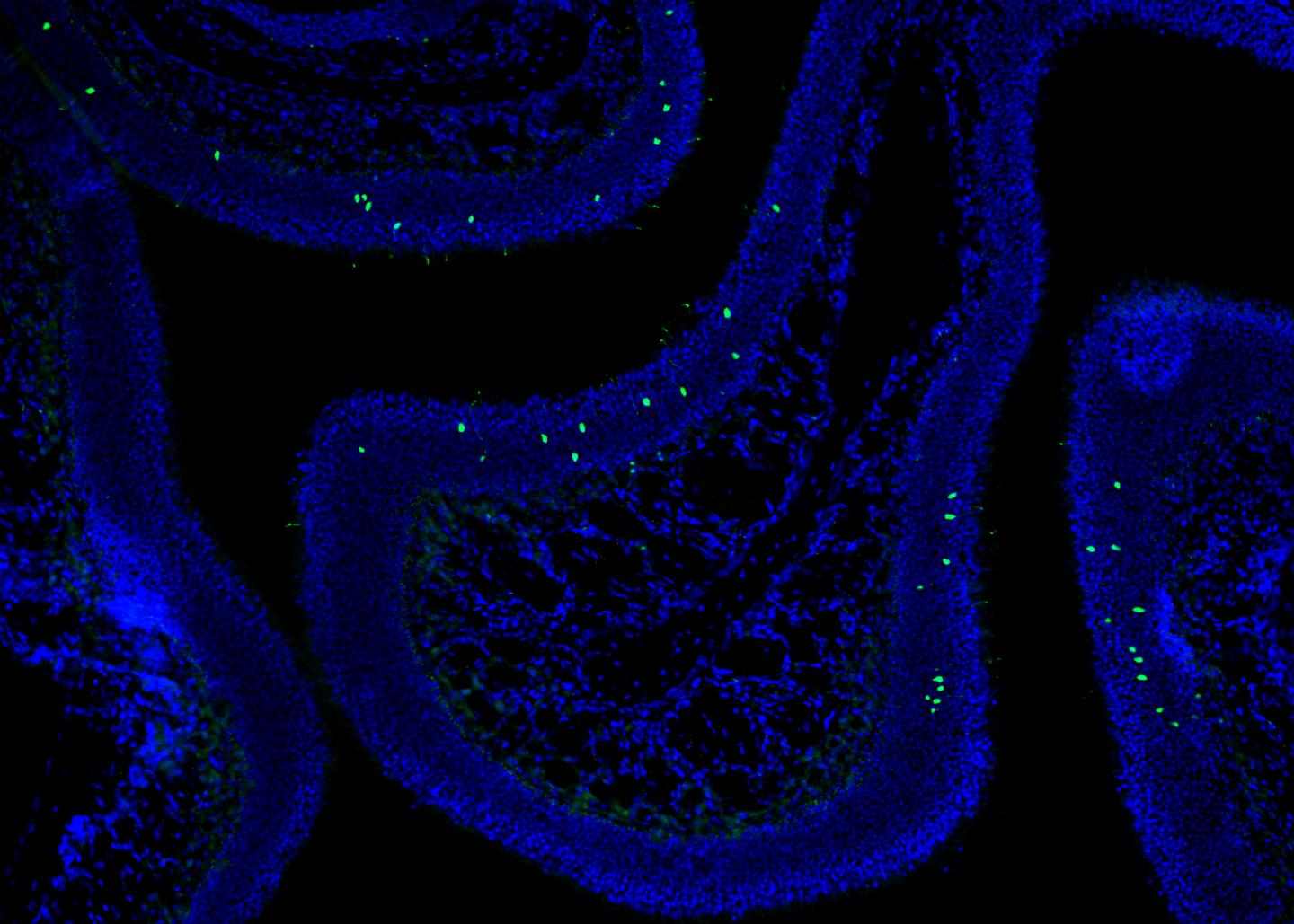 Olfactory Epithelium