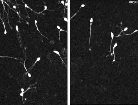 Adenosine Receptor Antagonists' Effect on Mouse Brain Development (1 of 1)
