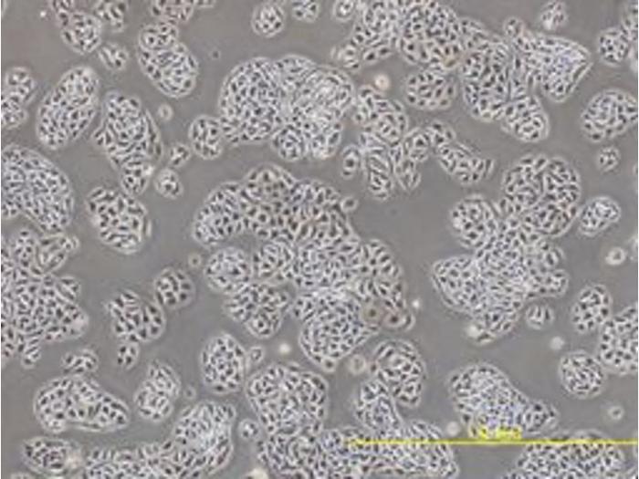 Kariwa and his team developed a new laboratory-grown cell line, called MRK101, derived from the kidney of the grey red-backed vole, to study how the Hokkaido virus interacts with host cells.