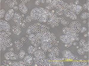 Kariwa and his team developed a new laboratory-grown cell line, called MRK101, derived from the kidney of the grey red-backed vole, to study how the Hokkaido virus interacts with host cells.