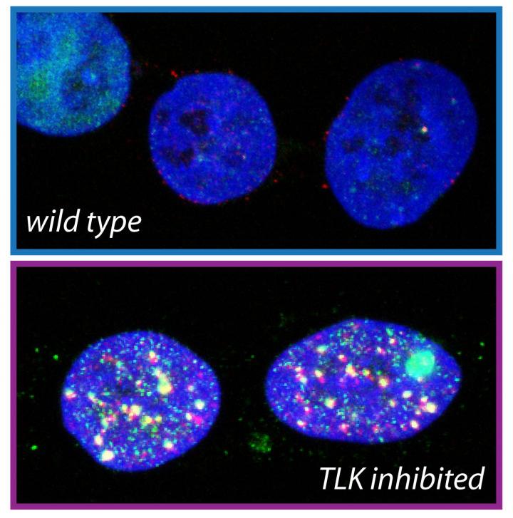 TLK Inhibition