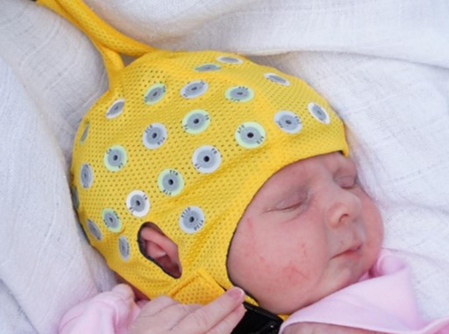 Changes in the Brain Activity