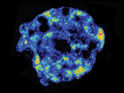 Heterogeneities in Cells of the Same Tissue