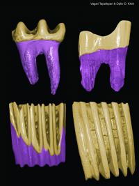 Crown: Root Ratios