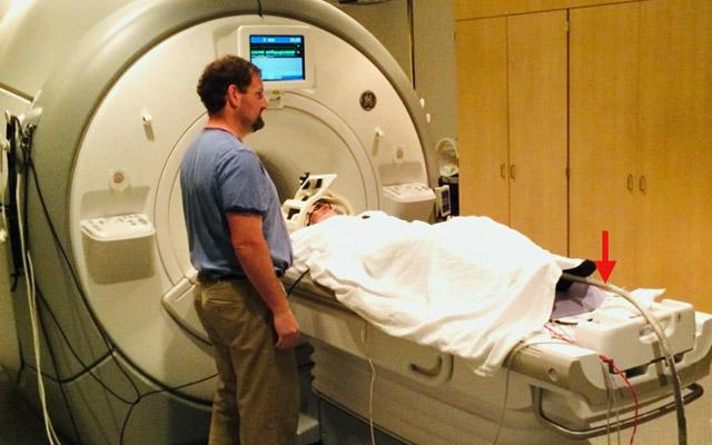 Vagus Nerve Stimulations, UC San Diego School of Medicine