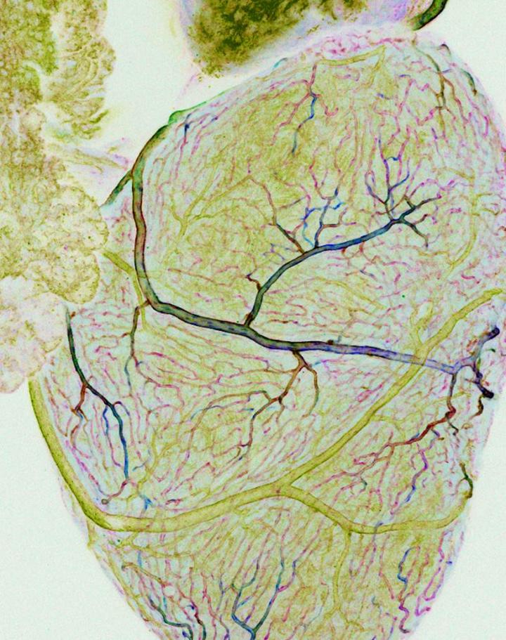Heart Image