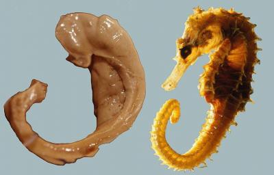 Hippocampus