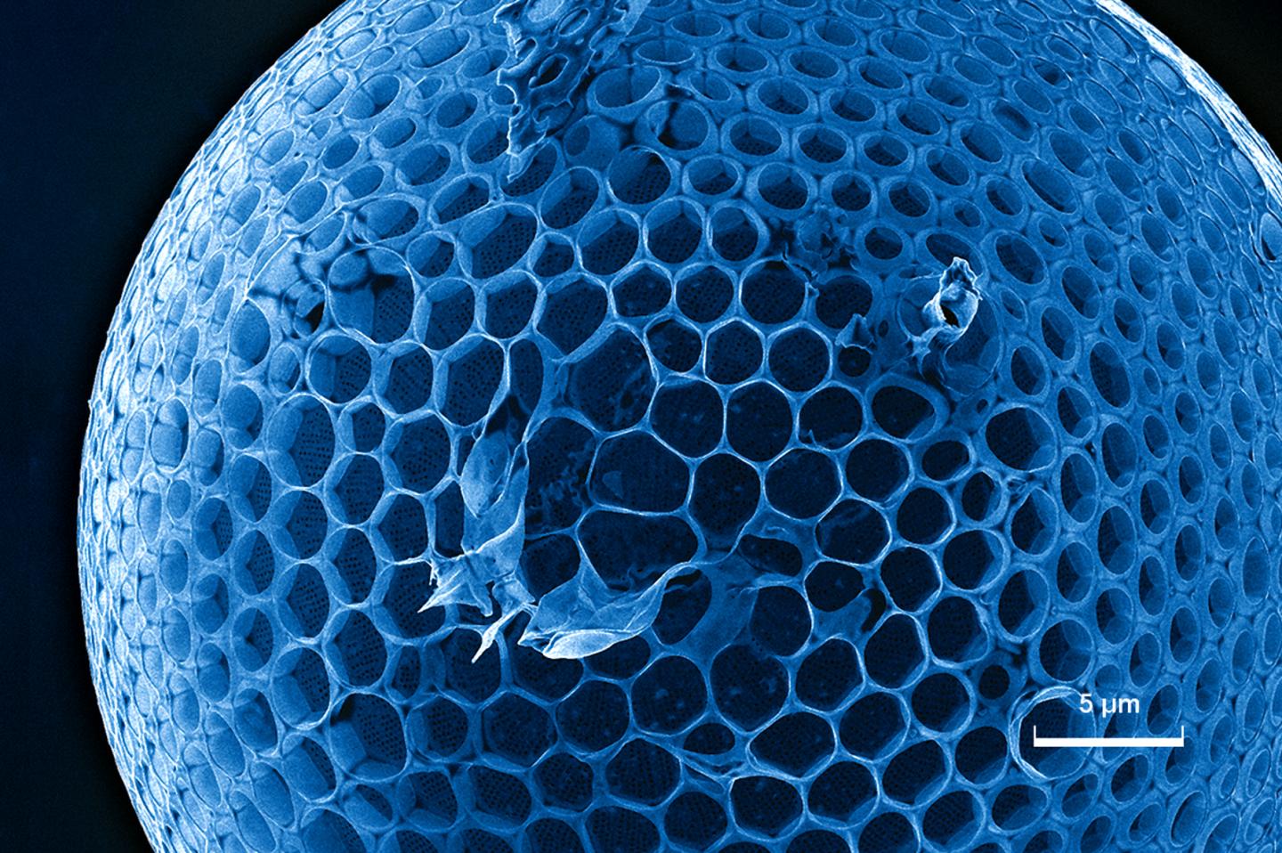 Diatom under the helium ion microscope at HZDR.
