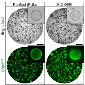 Organoids containing purified iPULs and AT2 cells