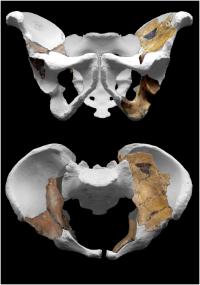 Pelvis