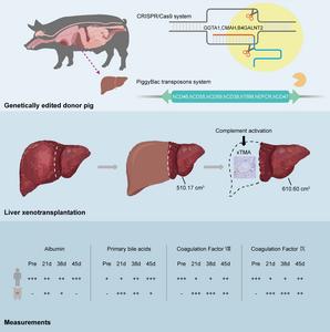 World’s First Pig-to-Human Liver Xenotransplant in a Living Recipient Reported in the Journal of Hepatology