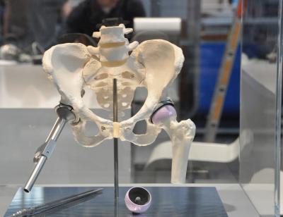 Hip Implant for Long-Term Use