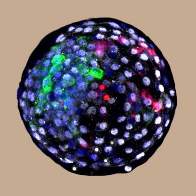 Human-monkey chimeric blastocyst