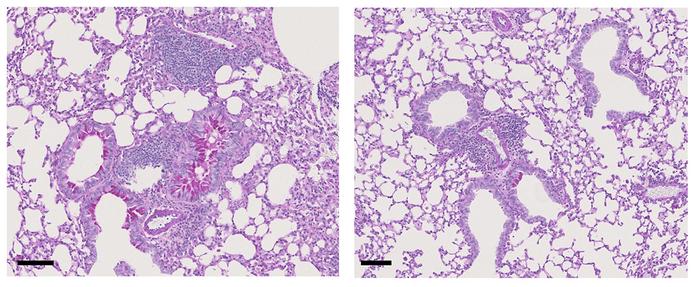 Genetically engineered regulatory T cells reduce allergic asthma symptoms in mice