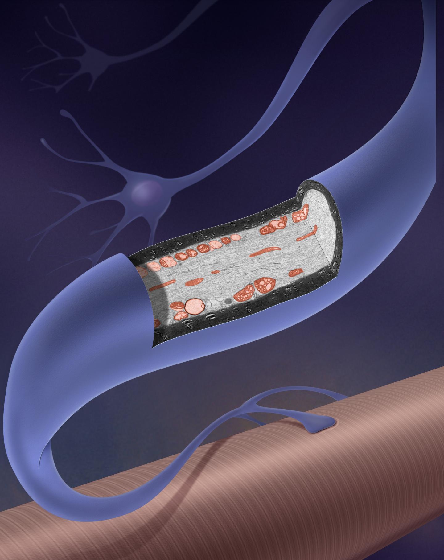 Cellular Garbage Causes Neurons to Break Down