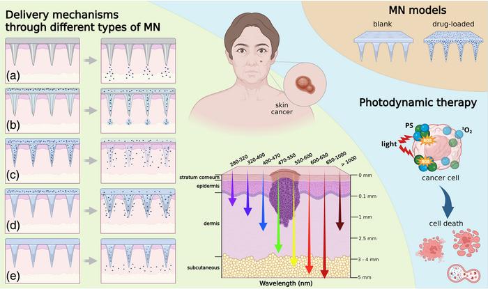 Schematic representation of MN technologies for transdermal drug delivery and optical guidance in PDT