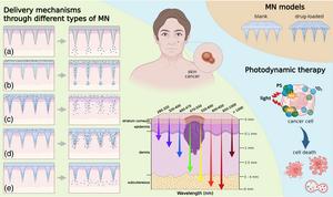 Schematic representation of MN technologies for transdermal drug delivery and optical guidance in PDT