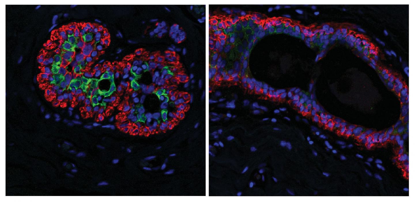 Breast Tissue