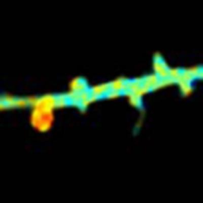 Dendritic Spine Formation in Single Synapse During Long-Term Potentiation