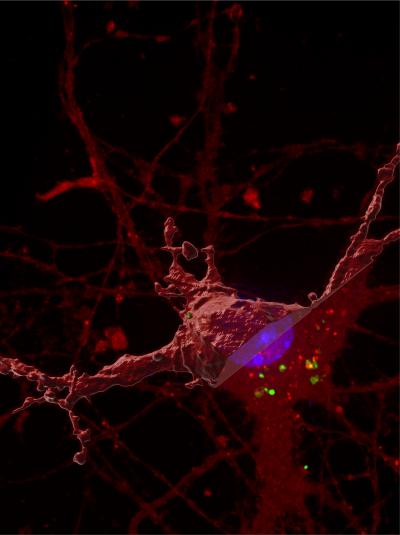 New discovery for how the brain 'tangles' in Alzheimer's Disease