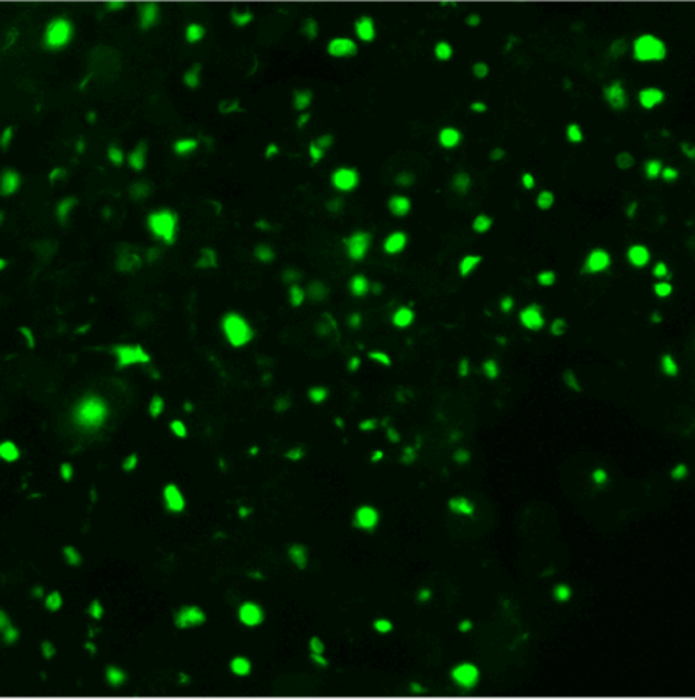 Misfolding protein