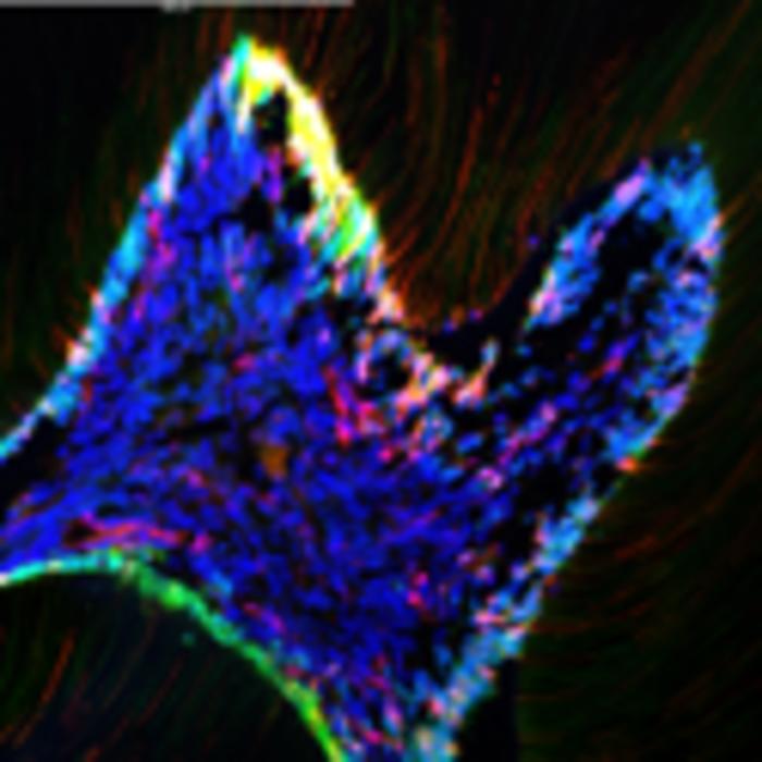 Stem cells at the root of tooth aging